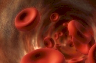 Hemofilia - vérzékenység Hemofilia - vérzékenység