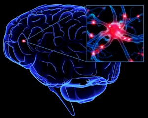 Sclerosis Multiplex Sclerosis Multiplex